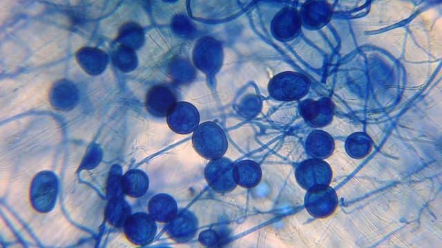 Tiny ancient fungi could slash Aussie fertiliser bill