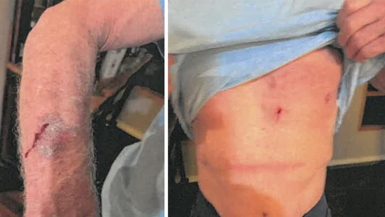 AFL legend left bloodied, bruised after home invasion