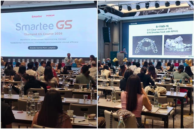 Smartee Hosts Academic Programs in Thailand Highlighting Mandibular Repositioning Technology