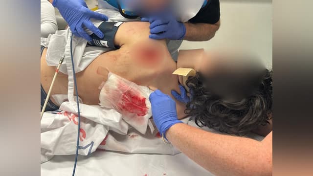 'Should we kill him?': chilling taunt in e-bike attack