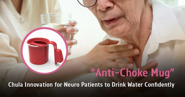 "Anti-Choke Mug" - Chula Innovation for Neuro Patients to Drink Water Confidently