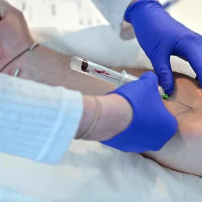 Blood-based marker can identify sleep deprivation