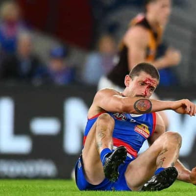 Liberatore on watch after boot to the head