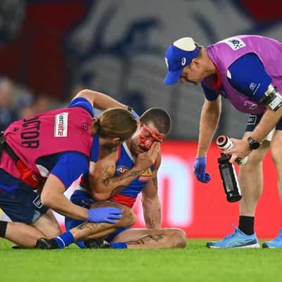 Liberatore set for AFL return after concussion concerns