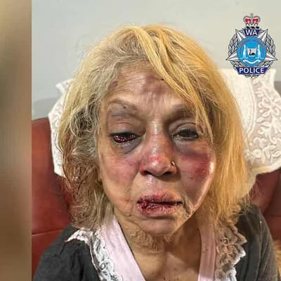 Ex-detainee to fight allegations he bashed grandmother