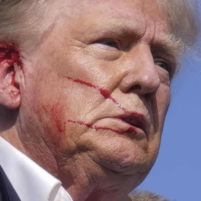 No, Donald Trump was not shot in the chest at rally