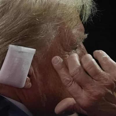 Trump's former doc gives new details on gunshot wound