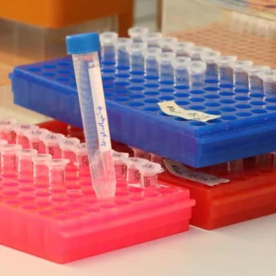 Mechanical engineers make AI sperm health test for IVF