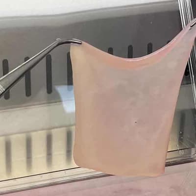 Breakthrough use of lab-grown skin on burns patient