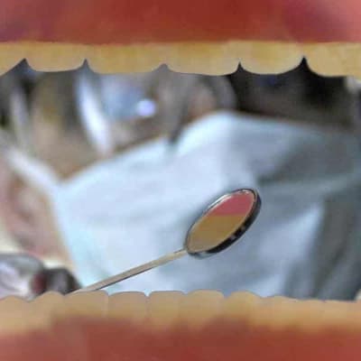 Dental body sinks teeth into private health policies