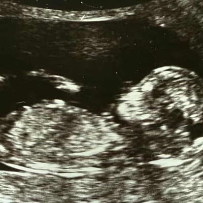 Spotlight on IVF regulation over embryo mix-up