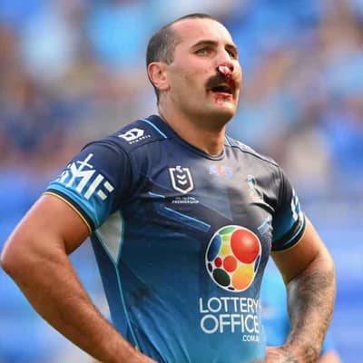 RCG 'nose' best as Titans aim to stop bleeding