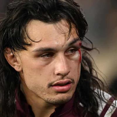 Titans make call on Tino after nasty eye injury