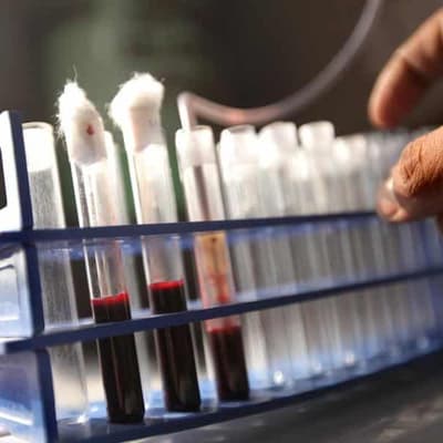 HIV transmission in Papua New Guinea at crisis levels