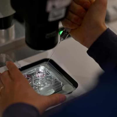 AI gives birth to fresh hope against male infertility