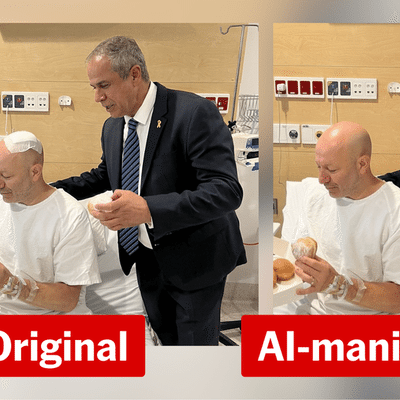 Wounded Bondi survivor again being targeted with AI-generated images