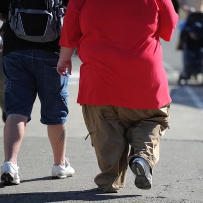 Growing obesity crisis tanking Aussie productivity