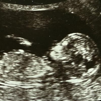 IVF giant again in play after new bid pumps up shares