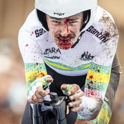 Broken elbow, concussion for Vine in Giro-ending crash