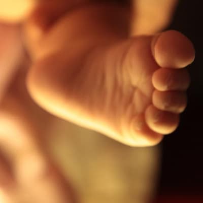 No, a law doesn't allow parents to euthanise babies they 'don't like'