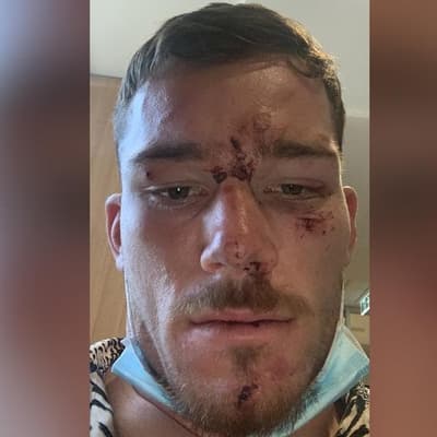Conflicting claims as cops fight NRL star assault case