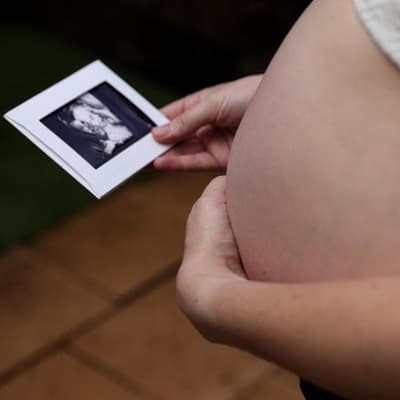 Australia is seeing 'lower activity' in the IVF space