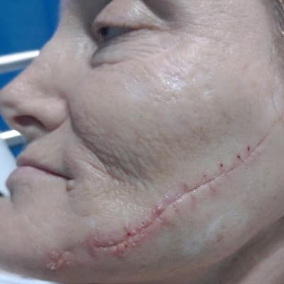 'Cackling': psychotic attacker stabs woman in her bed