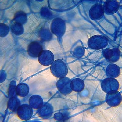Tiny ancient fungi could slash Aussie fertiliser bill