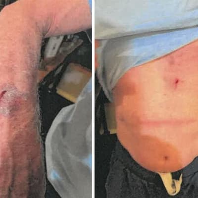 AFL legend left bloodied, bruised after home invasion