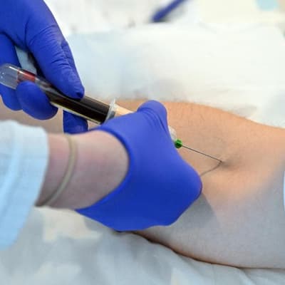 Alzheimer's blood test to radically change diagnosis