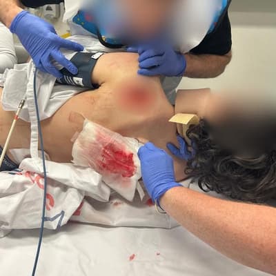 'Should we kill him?': chilling taunt in e-bike attack
