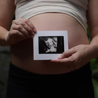 IVF provider sees new life in stimulated cycle numbers