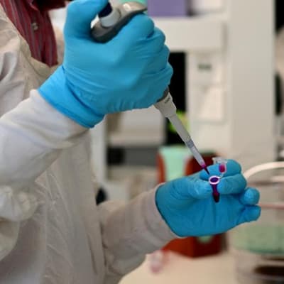 Elevated rates of MND found in regional Australia
