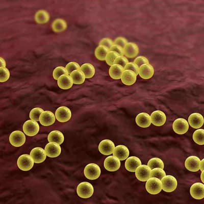 Golden staph outbreak rocks WA's premier rugby comp