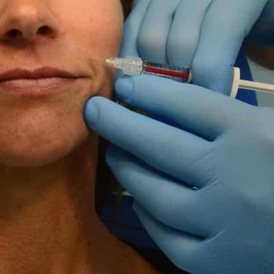 Cosmetic cowboys face fines with new surgeon laws